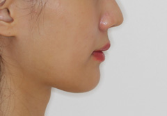 葛西の矯正　美しい口元